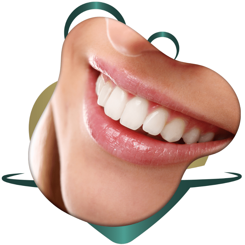 عروض تبييض أسنان وابتسامة بالطائف