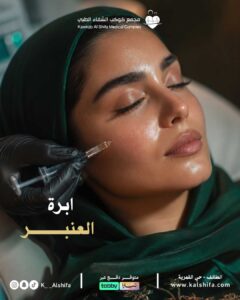 ابرة العنبر