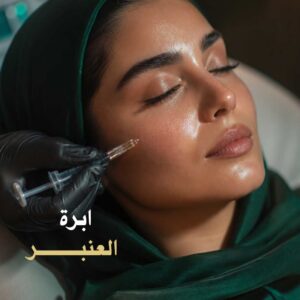 ابرة العنبر